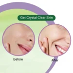 Neem Fresh Face Wash - 100 Ml - Image 3